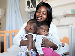 Conjoined twins, 2, separated at a Vatican paediatric hospital