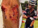 Pro cyclist reveals details of shocking attack after his £10,000 bike was stolen in Richmond Park  