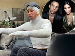 Olivier Rousteing reveals he suffered shocking burns when his fireplace exploded