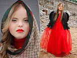 Model with Down’s syndrome, 22, gets signed to top agency