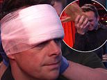 Ant McPartlin needed medical help after smashing head on COCONUT while filming Britain’s Got Talent