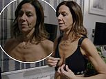 Julia Bradbury moves fans to tears in cancer documentary as she goes topless after mastectomy