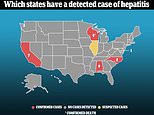 None of the nine young children in Alabama who had hepatitis tested positive for Covid