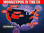 First potential human-to-human transmission of monkeypox detected in the United States